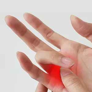 Boston Trigger Finger